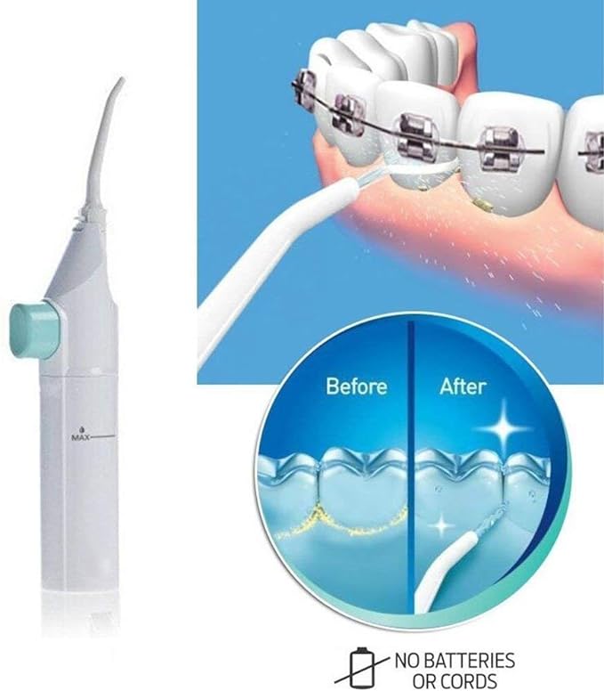 Dental Water Flosser