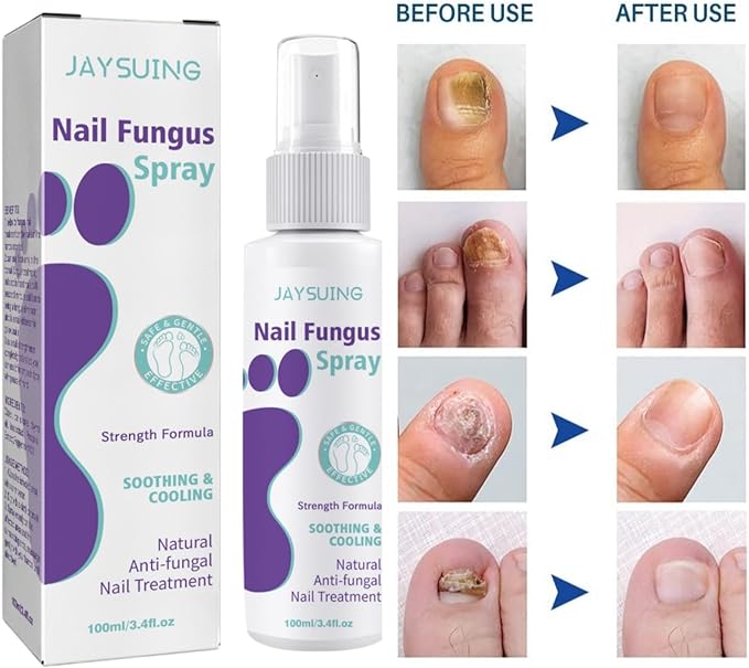 Nail Fungus Spray