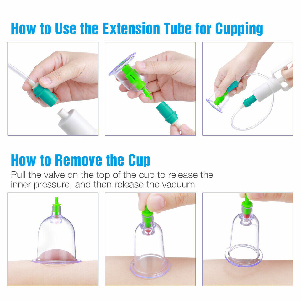 Body Cupping Healthy Set